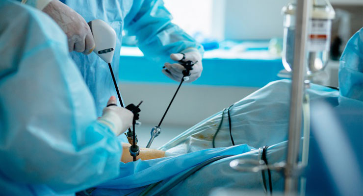 Value of Colored Fiber For Orthopedic Procedures to Spectra® MG BIO
